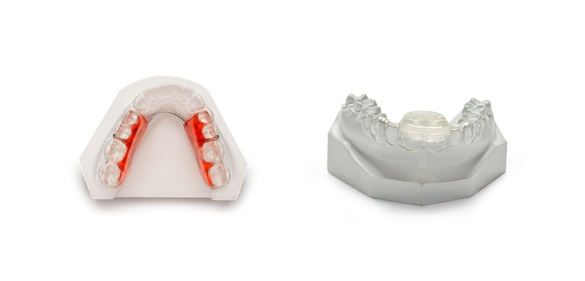 DENTAL SPLINTS: Materials, benefits, and features