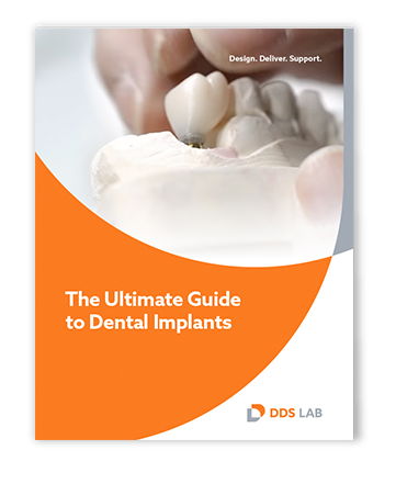 THE ULTIMATE GUIDE TO DENTAL IMPLANTS