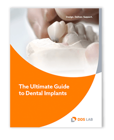 Ultimate Guide to Dental Implants | TechTalk