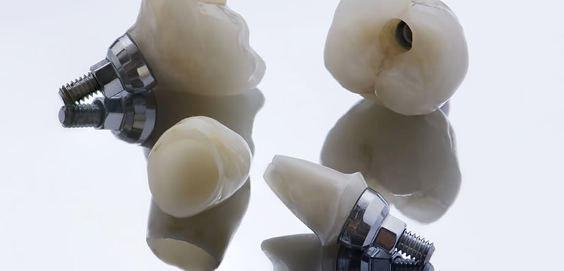 TYPES OF CROWNS TO USE WHEN PLACING A CUSTOM ABUTMENT